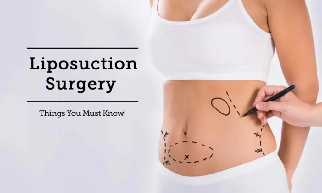 Things to do before liposuction 