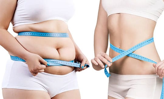 Lipo injections before and after
